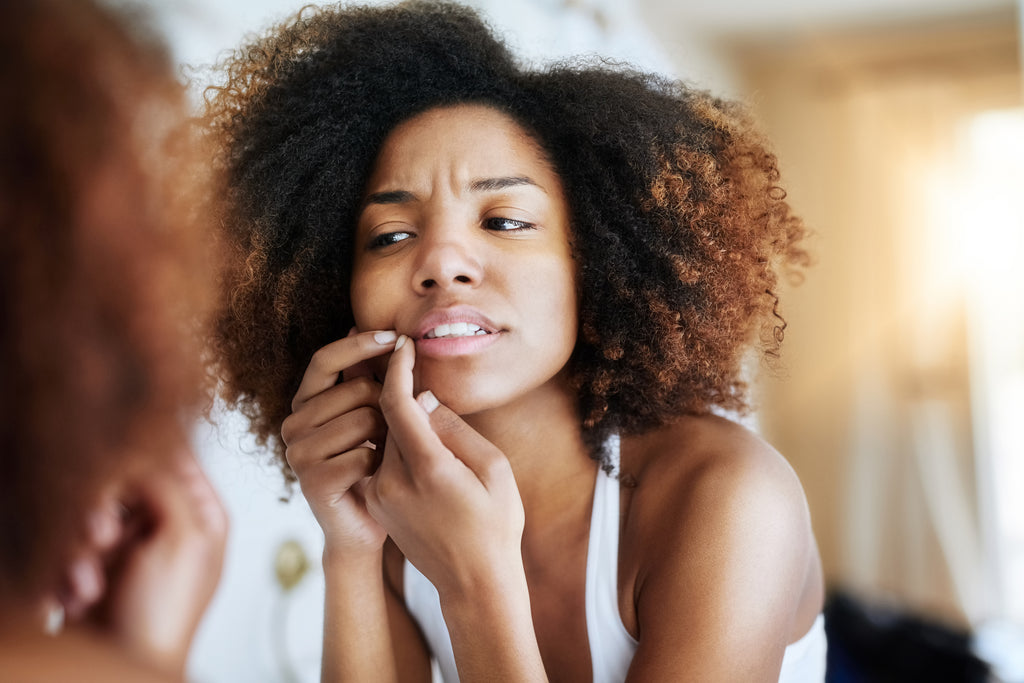 The Way to Stop Popping Pimples in the Deadly T Zone
