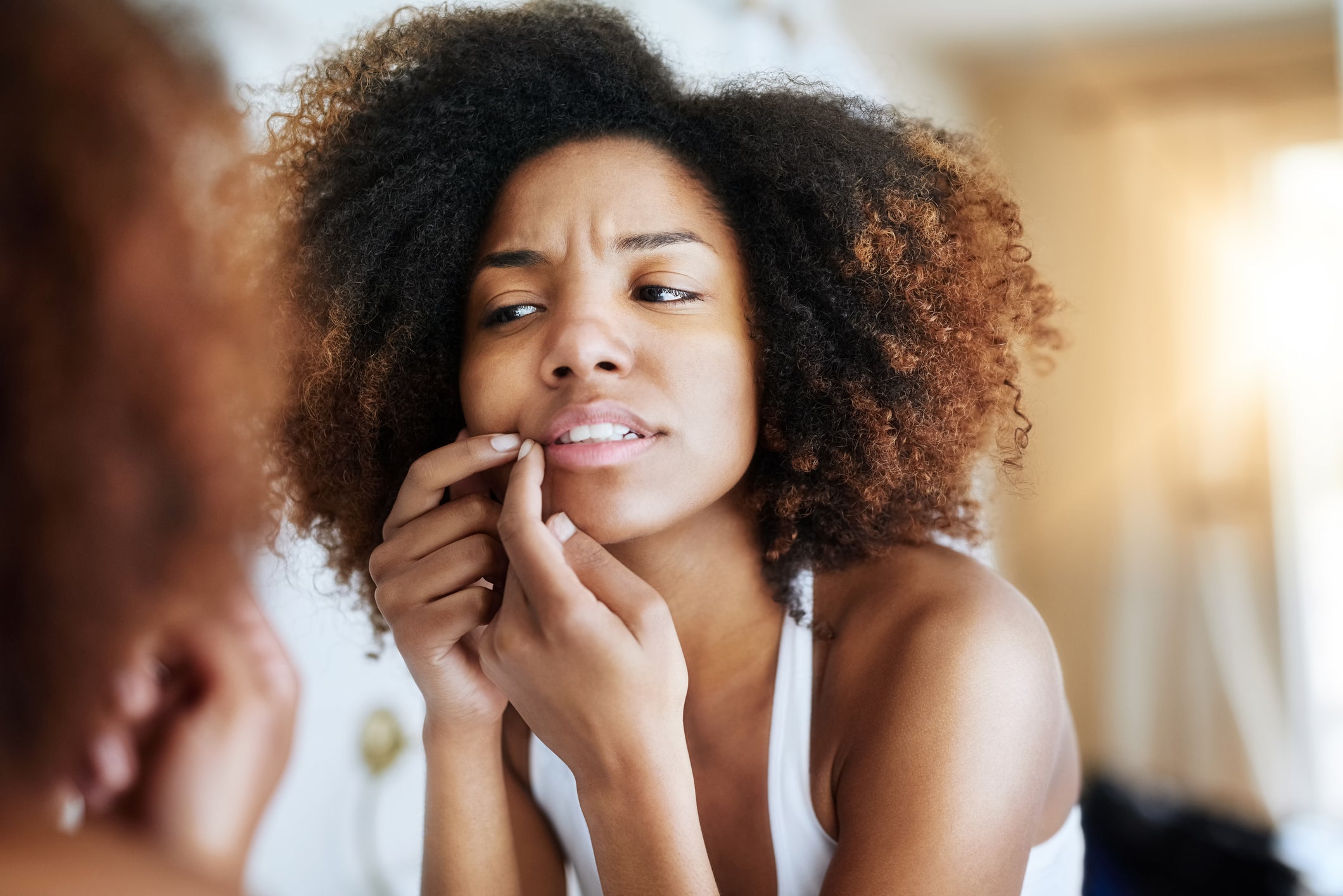 The Way to Stop Popping Pimples in the Deadly T Zone