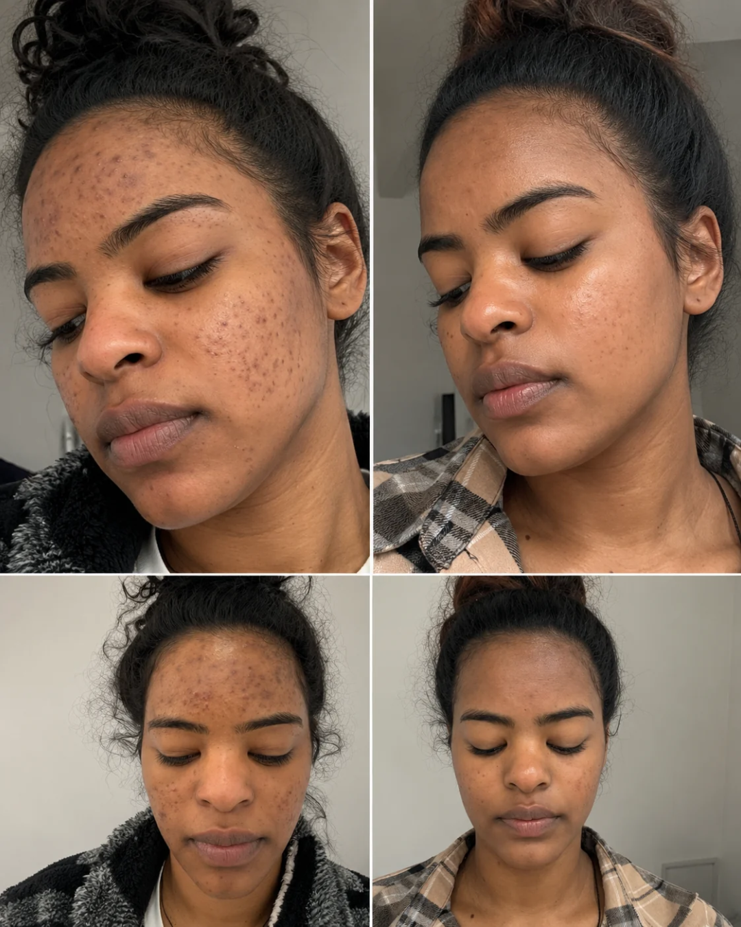 Scar & Blemish Cream